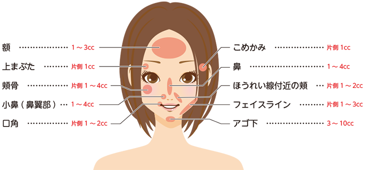 BNLS脂肪溶解注射の施術範囲一覧